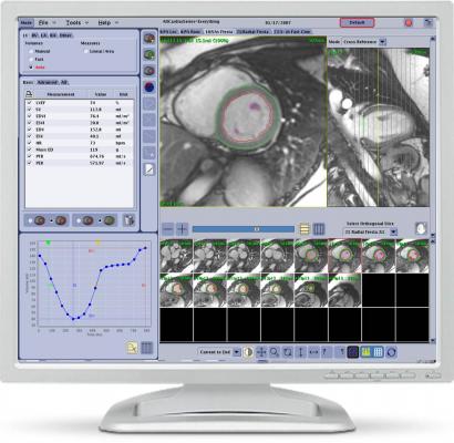 GE Healthcare Introduces New Cardiac MRI Analysis Software